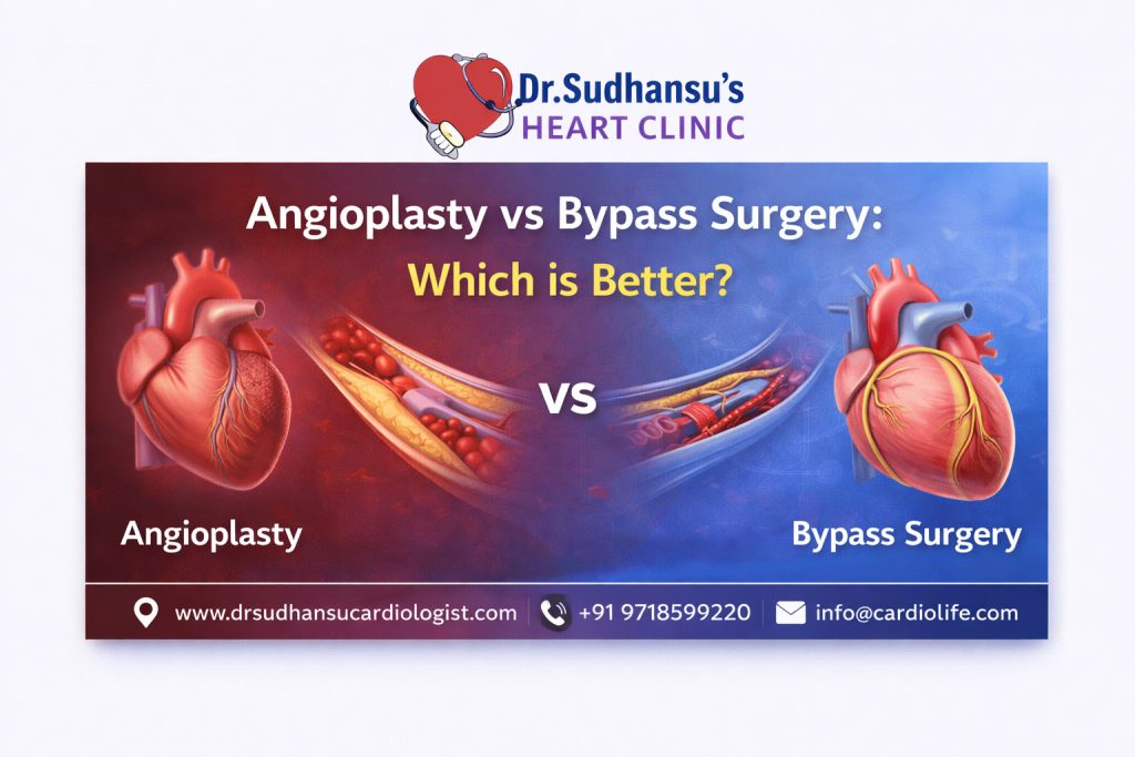 Angioplasty vs Bypass Surgery: Which is Better?